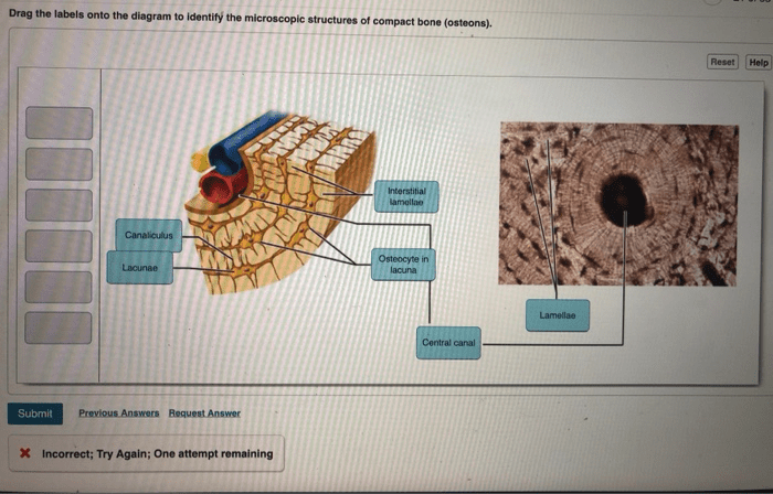 Drag the labels to identify the microscopic structures of bone