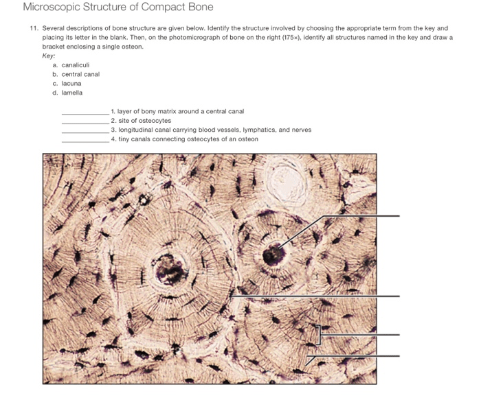 Drag the labels to identify the microscopic structures of bone